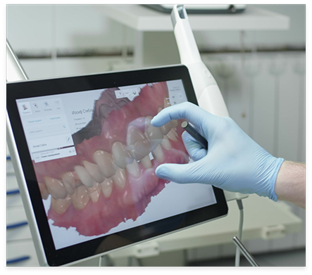 Dentist looking at screen showing digital impression of teeth